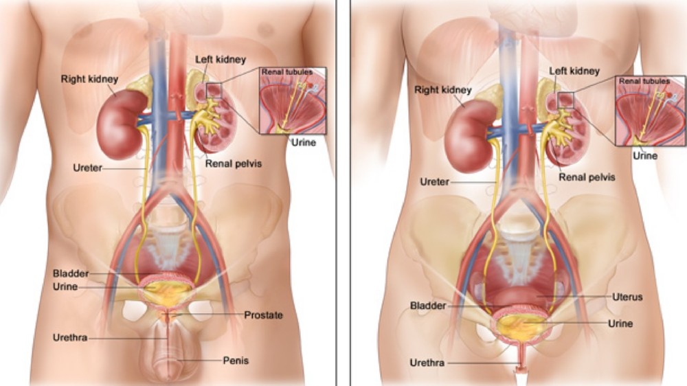 腎癌（腎細胞癌）