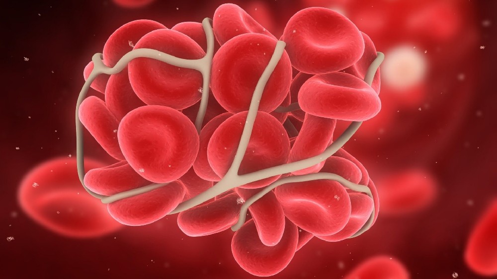 骨髓增生性腫瘤 MPNs