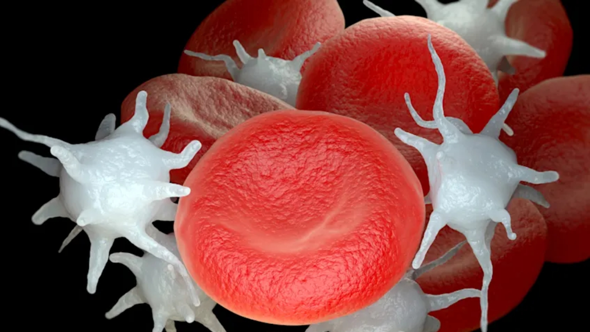 Essential Thrombocythemia (ET)