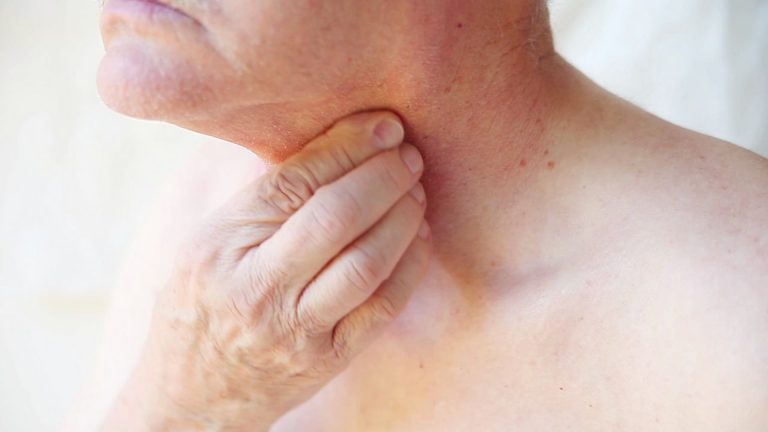 Hypopharyngeal Cancer (Hypopharyngeal Carcinoma)