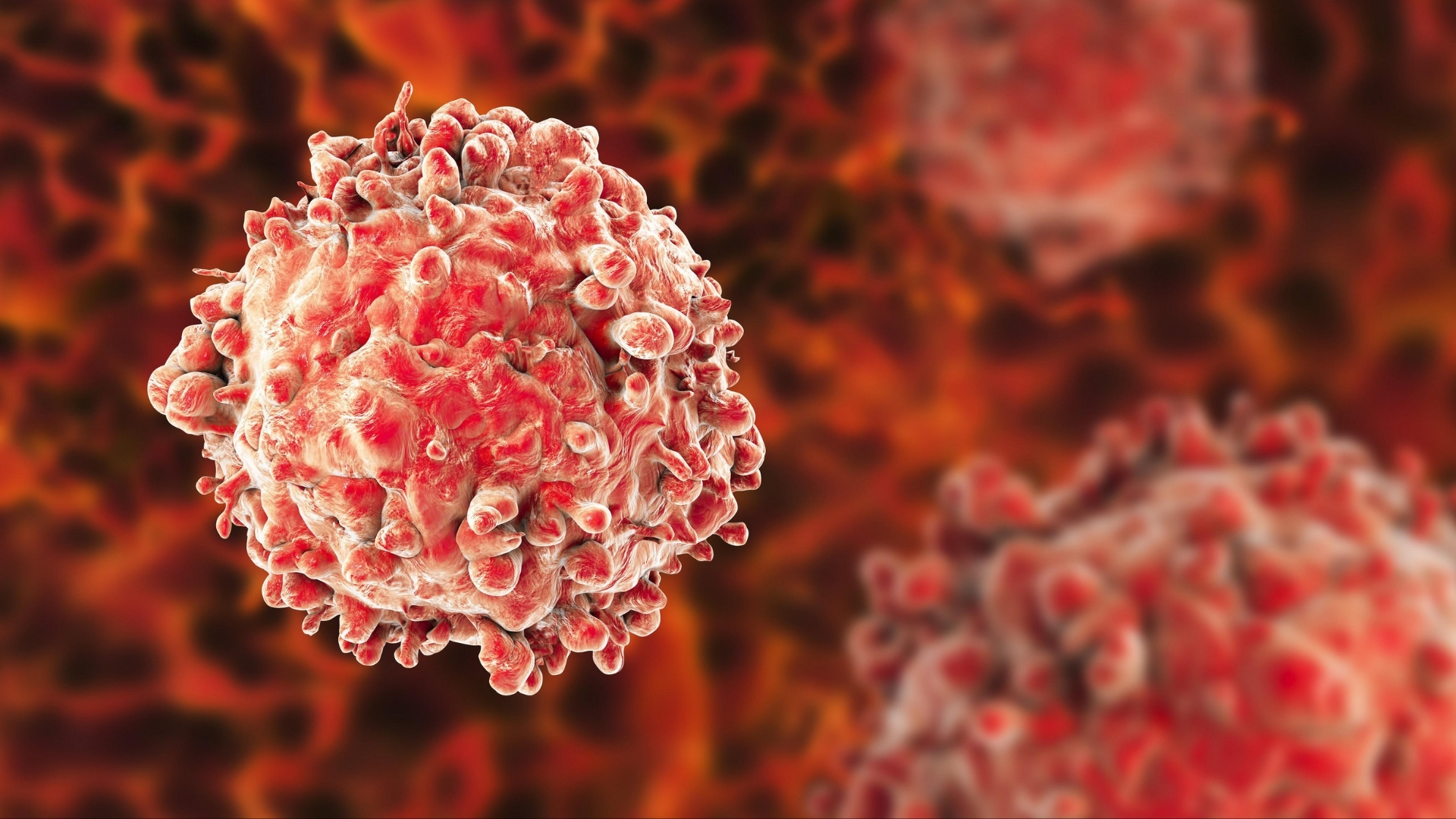 Leukemia