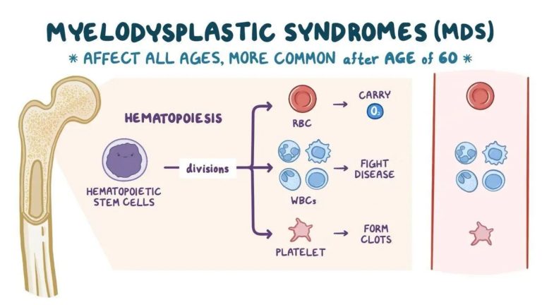 Myelodysplastic Syndromes