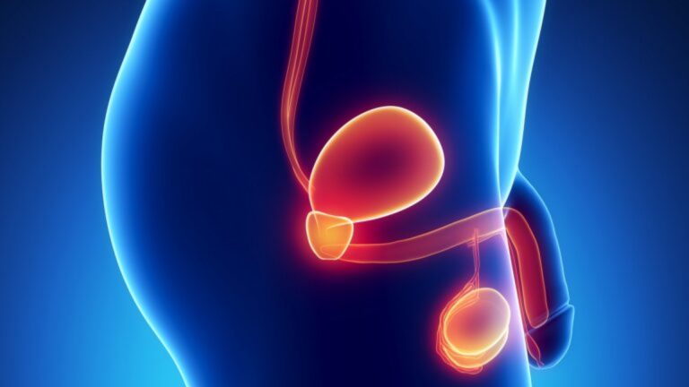 Penile Cancer (Penile Carcinoma)